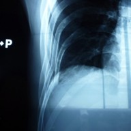 P1060234